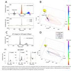 Dynamic predictive accuracy of electrocardiographic biomarkers of sudden cardiac death within a survival framework: the Atherosclerosis Risk in Communities (ARIC) study